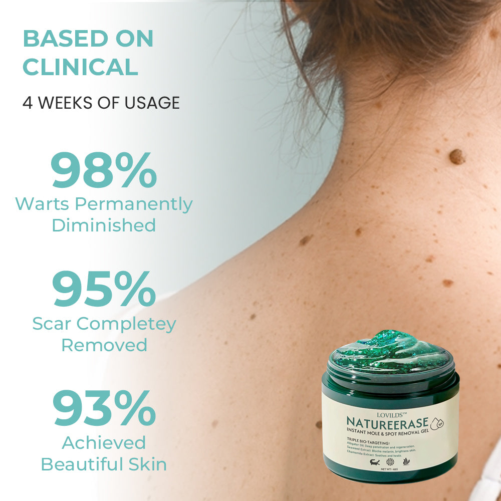 ✅ Official Store: LOVILDS™ NatureErase Instant Alligator Oil Mole & Spot Removal Gel