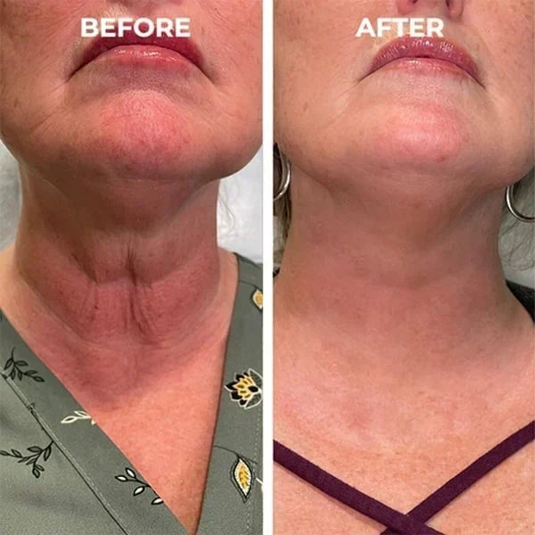 Flash Sale Ending Soon! Skin Radiance Renewal Cream 